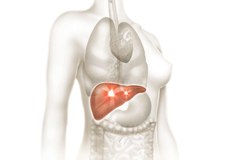 4-fatores-que-geram-cancer-de-figado