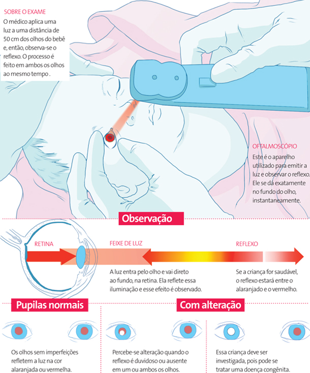 teste_do_olhinho_para_bebes
