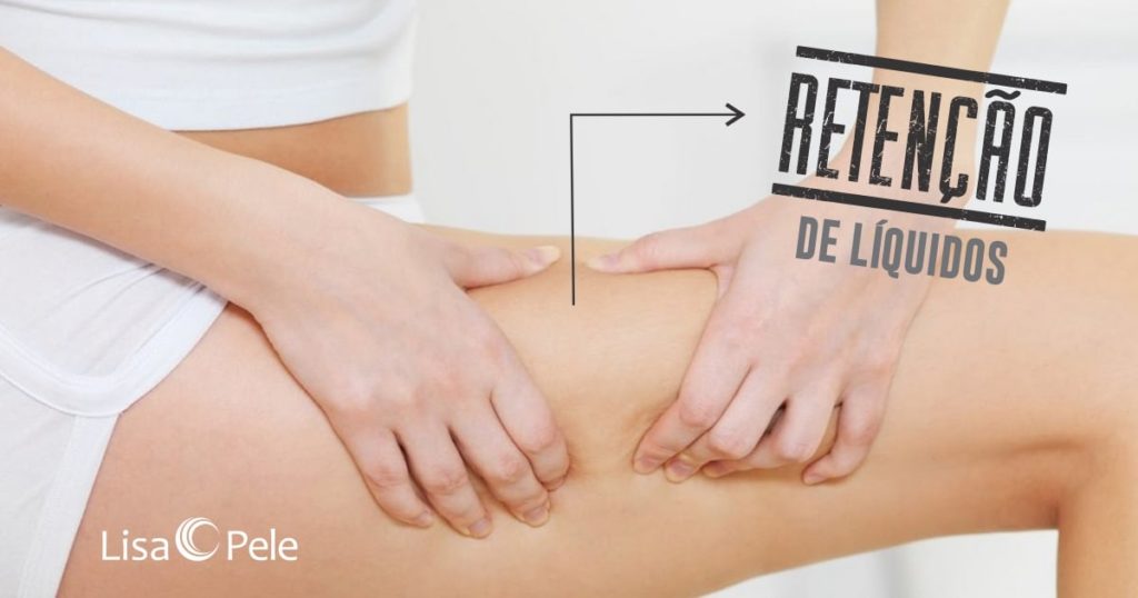 O que é retenção de líquido? Conheça as principais causas e como ...