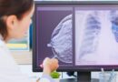 Mamografia: o que é, para que serve, como é feita e resultados